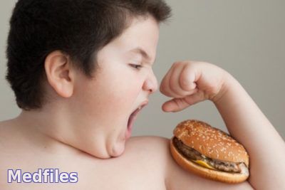 Детское ожирение : причины,виды,лечение.